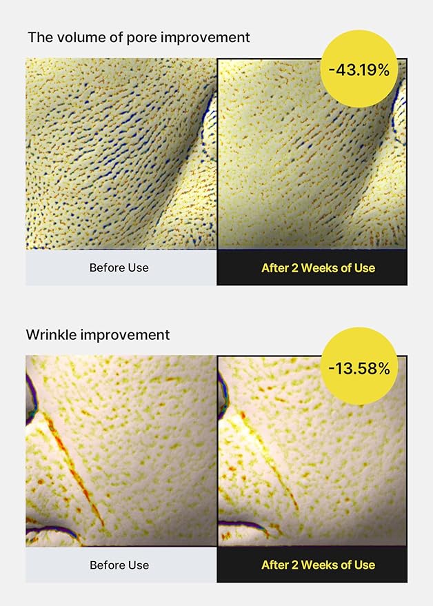 Hoygi | Retinal Shot Tightening Serum